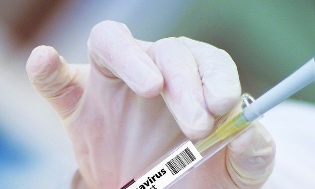 Aktuell 13 Corona-Fälle in Wunstorf – 39 Corona-Todesfälle in der Region – insgesamt 1619 Corona-Infizierte in der Region Hannover