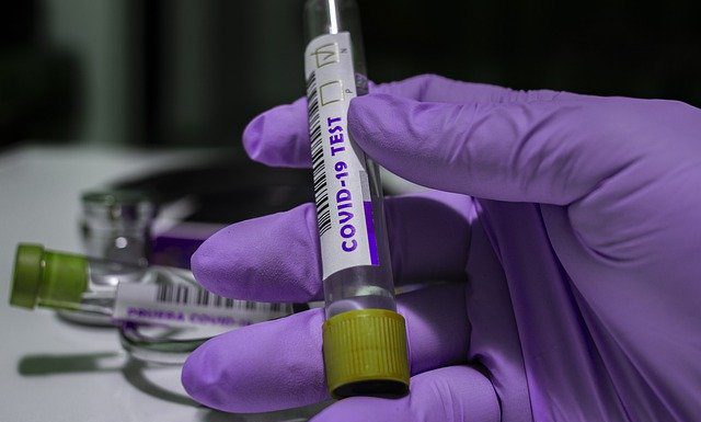 Aktuell 4 Corona-Fälle in Wunstorf – weitere Zahlen der gesamten Region Hannover