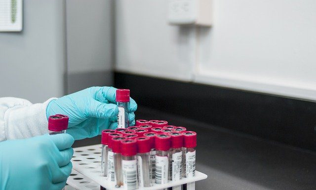 Aktuell 2 Corona-Fälle in Wunstorf – weitere Zahlen der gesamten Region Hannover